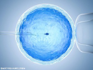 男性不妊
